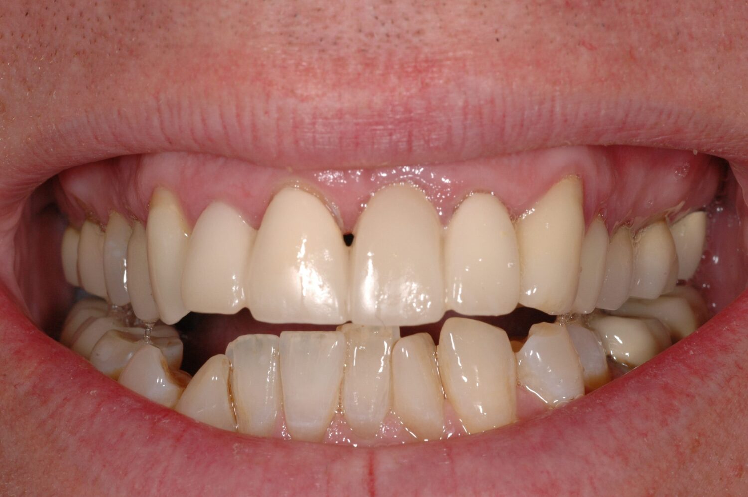 before image
